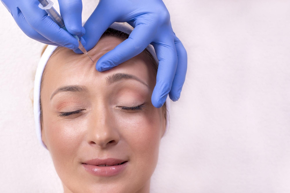 Botox for Forehead Lines: Smoothing Expression Wrinkles Safely